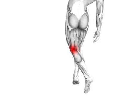 Osteoarthritis of the knee joint