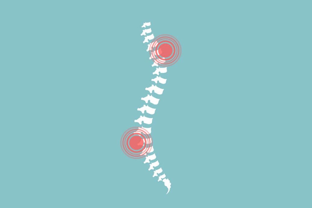 human spine and back pain