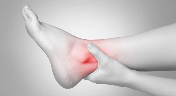 Joint stiffness and chronic ankle pain are complications of crusarthrosis